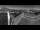 Webcam at mount Petzen, 8.1 mi away