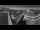 Webcam am Petzen, 0.8 km entfernt