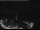 Webcam in Tennenbronn, 11.8 mi away