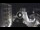 Webcam in Meran, 0.3 mi away