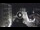 Webcam in Meran, 1 mi away