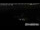 Webcam in Bad Kleinkirchheim, 6.1 km entfernt