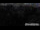Webcam in Neustift im Stubaital, 2 km entfernt
