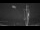 Webcam in Marinella di Sarzana, 0.5 mi away