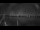 Webcam in Chestermere, 64.6 mi away