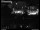 Webcam in Dresden, 1.6 mi away
