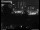 Webcam in Dresden, 0.3 mi away
