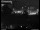 Webcam in Dresden, 2.5 mi away