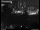 Webcam in Dresden, 1.8 mi away
