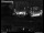 Webcam in Dresden, 2.5 mi away