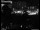 Webcam in Dresden, 2.5 mi away