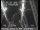 Webcam in San Francisco, Californien, 3.8 km
