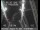 Webcam in San Francisco, Californie, 10.9 km