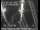 Webcam in San Francisco, Californie, 14.2 km