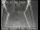 Webcam in San Francisco, California, 4 mi away