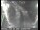 Webcam in San Francisco, California, 4.8 km