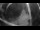 Webcam in Montsauche-les-Settons, 32.5 mi away