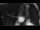Webcam in San Francesco al Campo, 7 mi away