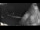 Webcam in San Francesco al Campo, 7 mi away