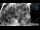 Webcam in Hard, 9.6 km