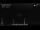 Webcam auf der Enchanted Princess, 59.6 km entfernt