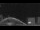 Webcam en el Norwegian Luna, 324.9 km