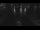 Webcam in Glowe, 11.8 km