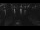 Webcam in Glowe, 12.4 km