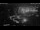Webcam in Pirna, 1.6 mi away