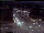 Webcam in Wuppertal, 5.2 mi away