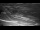 Webcam in Eidsbugarden, 98.7 mi away