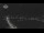 Webcam in Interlaken, 1.9 mi away