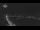 Webcam in Interlaken, 1.7 mi away