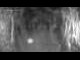 Webcam in Gossensaß, 1.7 mi away