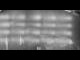 Webcam in Cauterets, 22.1 km