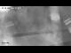 Webcam in Norden, 1.2 mi away